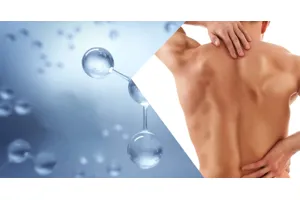 Ossigeno Ozono Terapia 