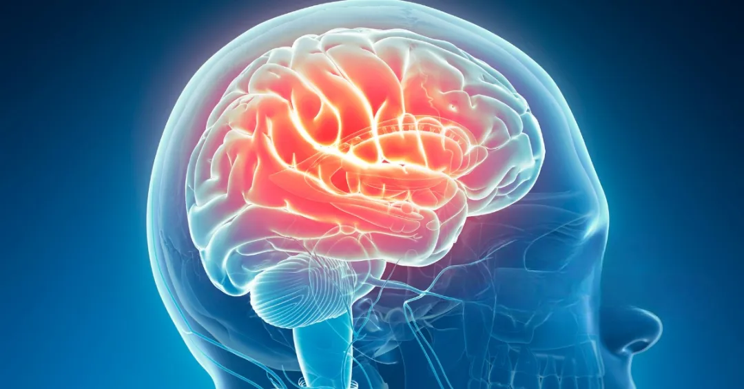 Neurologia 