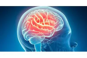 Neurologia 