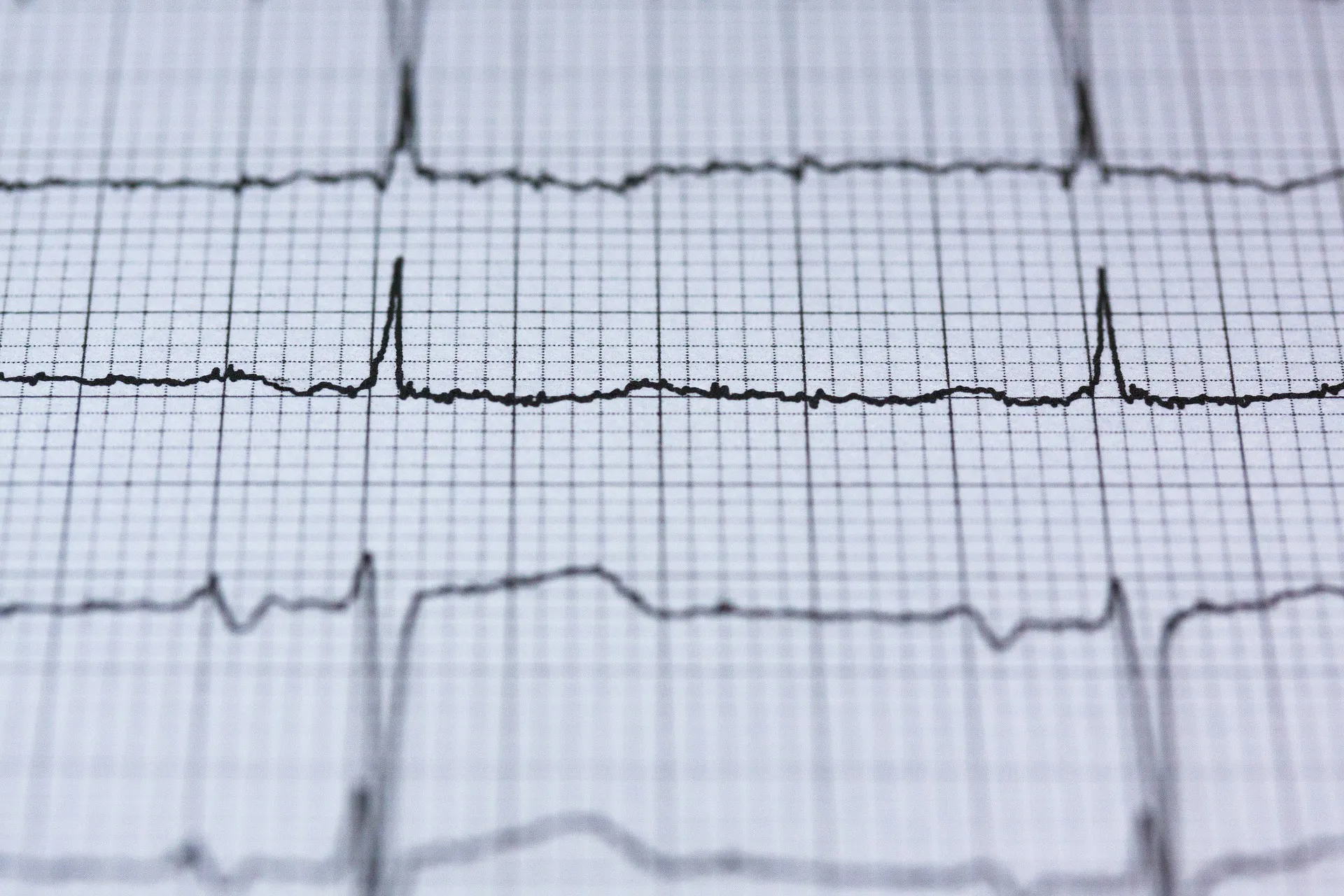 Holter ECG 24/28/72 H