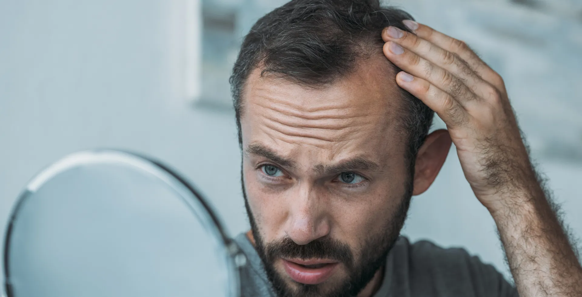 ALOPECIA: Di cosa stiamo parlando?