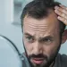 ALOPECIA: Di cosa stiamo parlando?