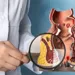 Malattie del colon-retto