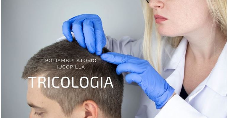 Tricologia: ci prendiamo cura dei vostri capelli. Prevenzione e terapie d'urto. dott. Amuso Domenico