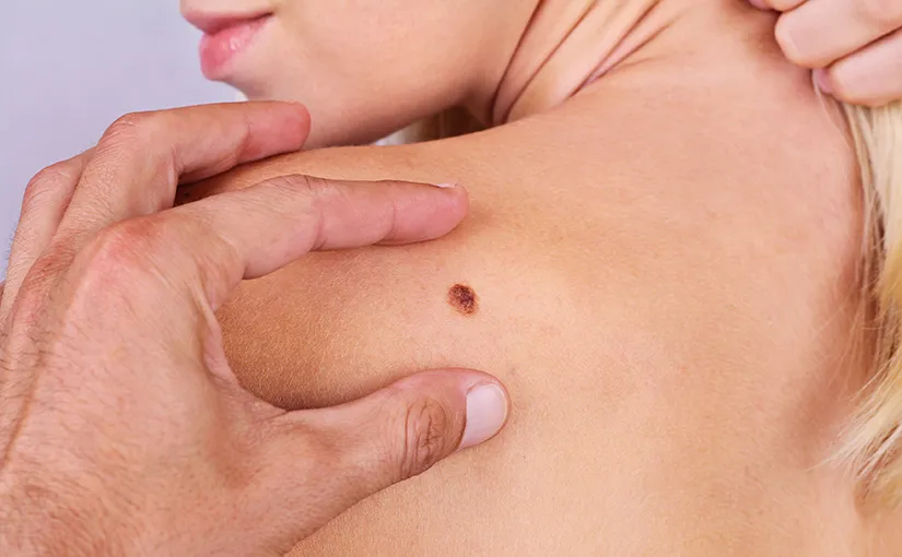 Dermatologia 