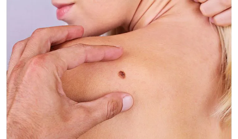 Dermatologia e Venerologia